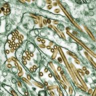 Colorized transmission electron micrograph of Avian influenza
